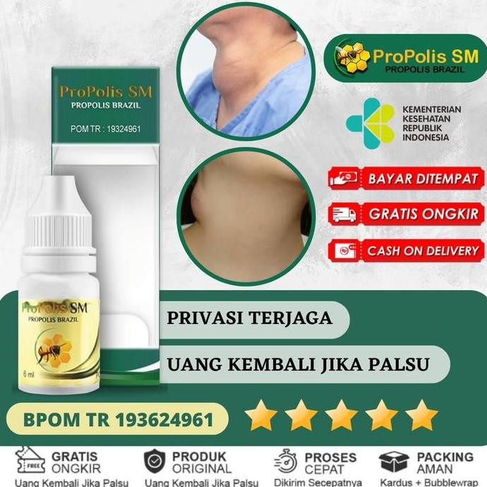 

Sale Penghilang Pengempis Benjolan Di Leher, Benjolan Kelenjar Getah Bening, Benjolan Di Payudara, Uci Uci, Benjolan Lipoma