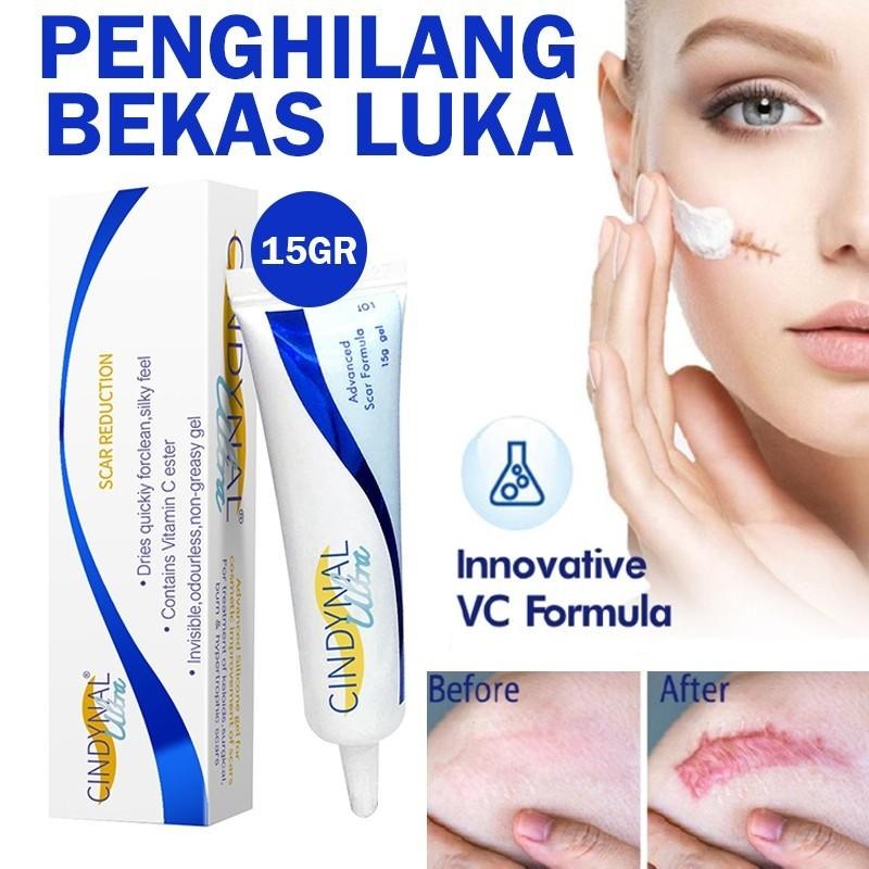 Ls [ Paketan ] Zudaifu Salep Gatal & Cream Penghilang Bekas Luka Cindynal