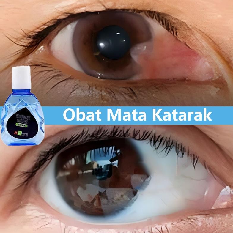 Ready Obat Tetes Mata Obat Mata Katarak Eye Drop Obat Mata Buram Obat Mata Berlemak Tetes Mata Herba