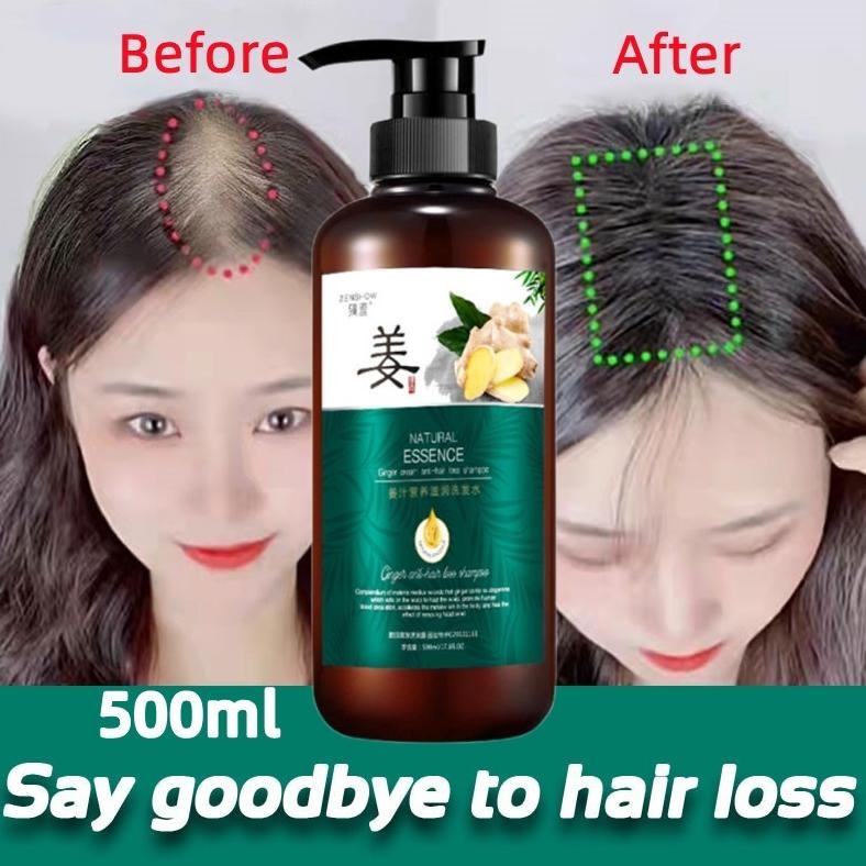 BEST SELLER ZHENXIU SHAMPO JAHE 500ML | SAMPO PENUMBUH RAMBUT CEPAT | SHAMPOO RAMBUT RONTOK | SHAMPO