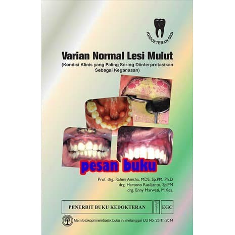 TERLARIS Buku Varian Normal Lesi Mulut - Rahmi Amtha