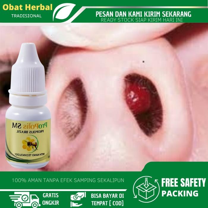 Cairan Tetes Polip Hidung, Sinusitis Hidung Bau Busuk, Hidung Tersumbat, Penghilang Benjolan Didalam