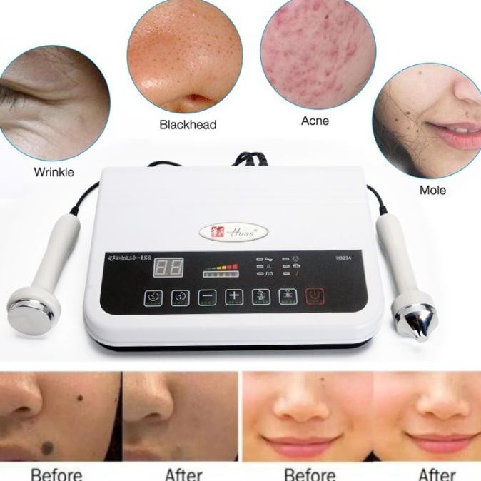 Terlaris Alat Detox Wajah Ultrasound Kantung Mata Soft Cauter Laser Penghilang Flek Kutil Tai Lalat 