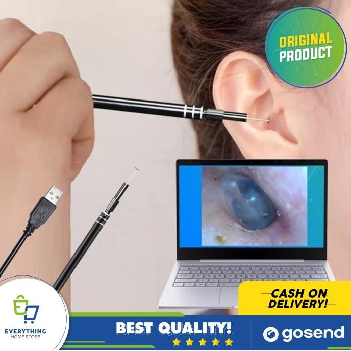 Baru Korek Kuping Anak Dengan Kamera | Korek Kuping Dengan Kamera