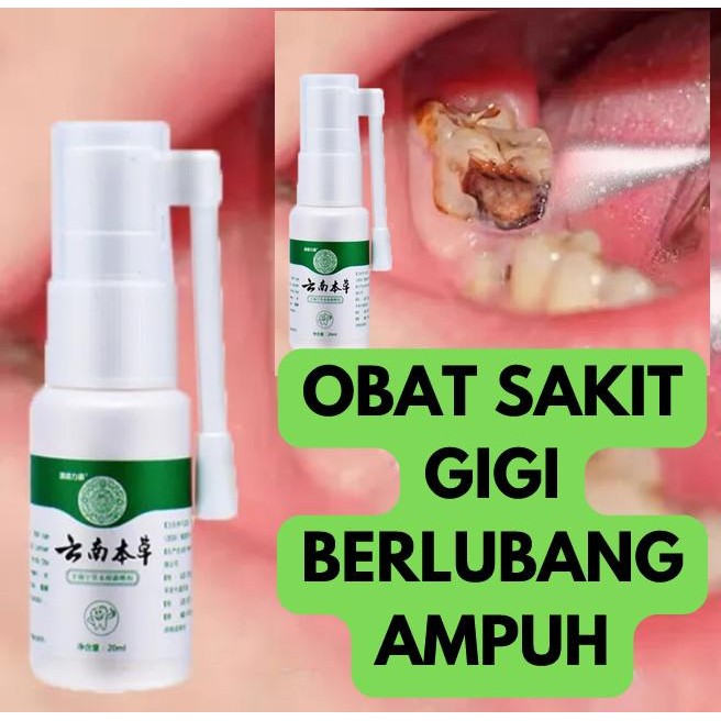 Obat sakit gigi berlubang herbal anak dan dewasa OBAT SPRAY
