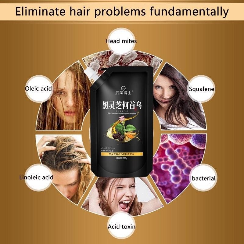 Polygonum Multiflorum Penghilang Uban Shampoo 300Ml Anti Hair Fal Hair Treatment Oil Control Anti-Da