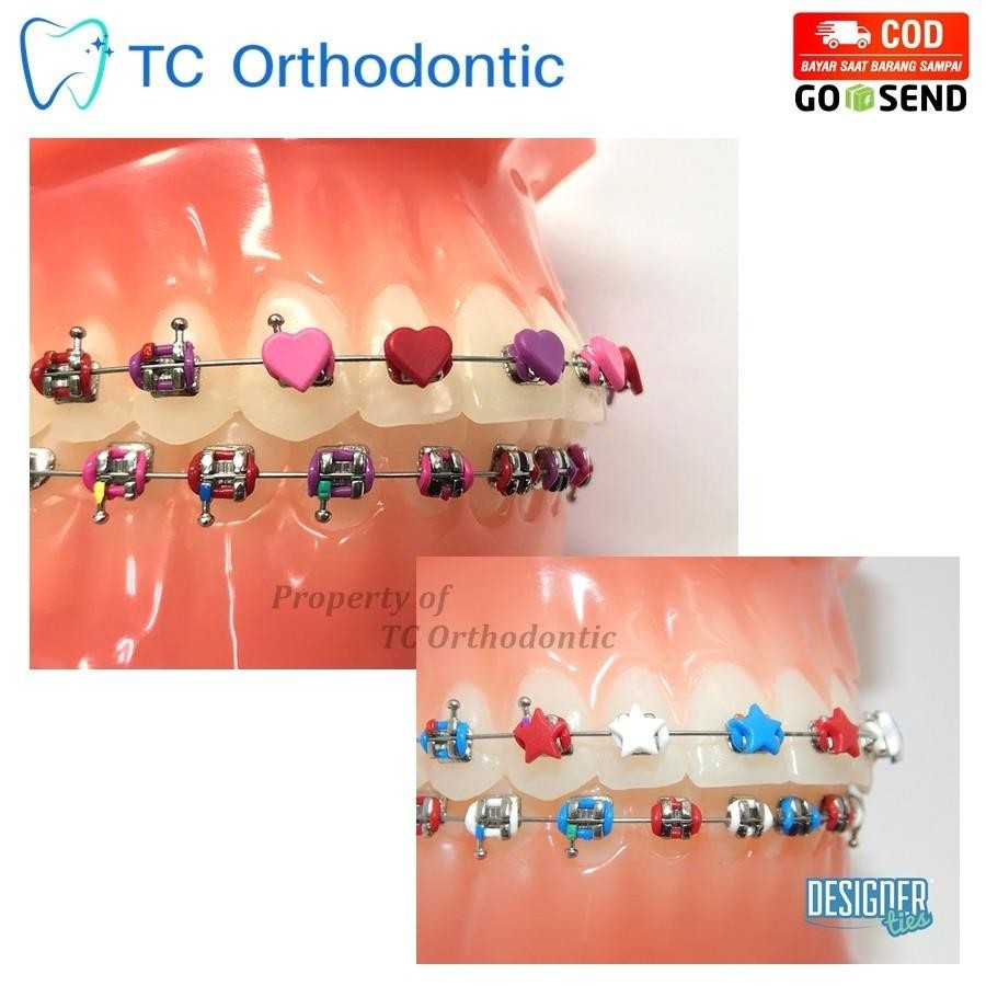 Karet Behel Power O / Karet Behel Motif Designer Ties / Karet Bracket Gigi 3D Germany Warna Merah