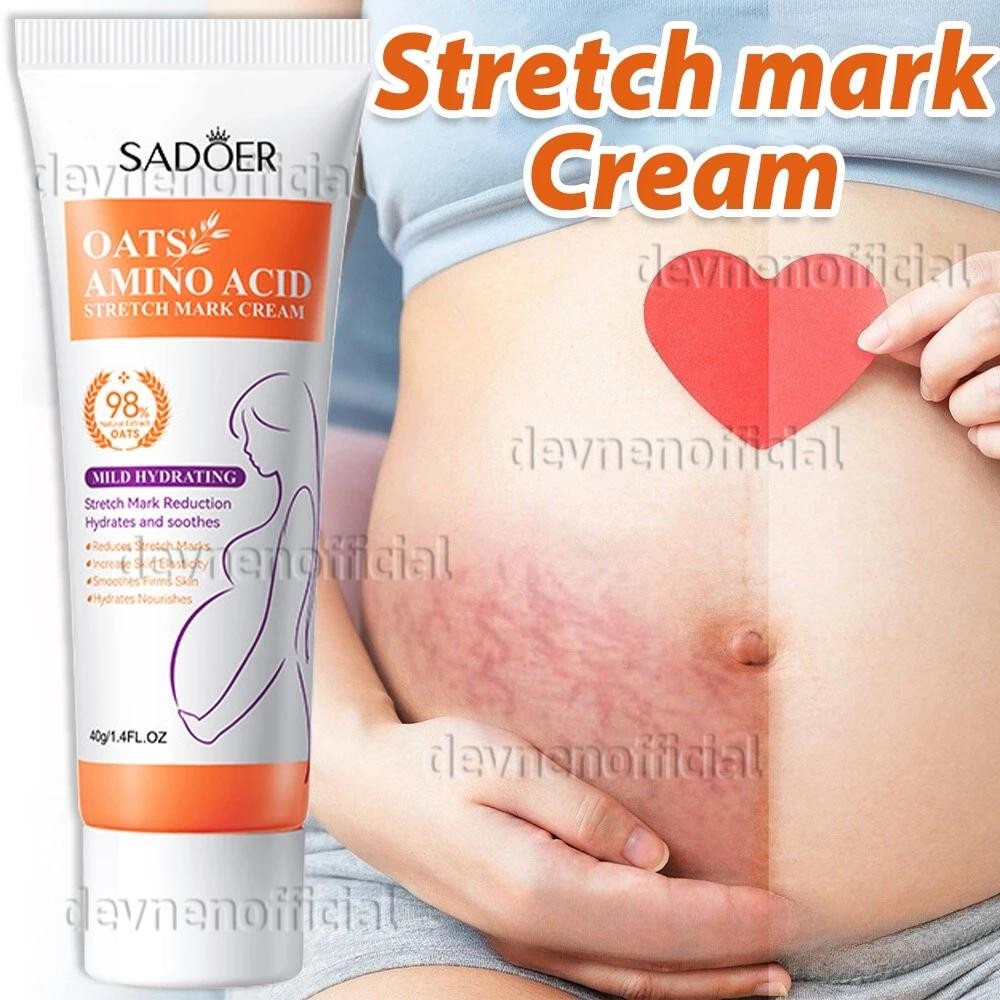 Krim Penghilang Stretch Mark Krim Stretch Mark Ori Bpom Stretch Mark Cream Penghilang Bekas Luka Kri
