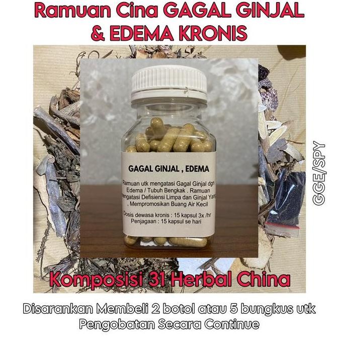 Obat Sinshe Cina GAGAL GINJAL KRONIS dan EDEMA/BENGKAK KRONIS