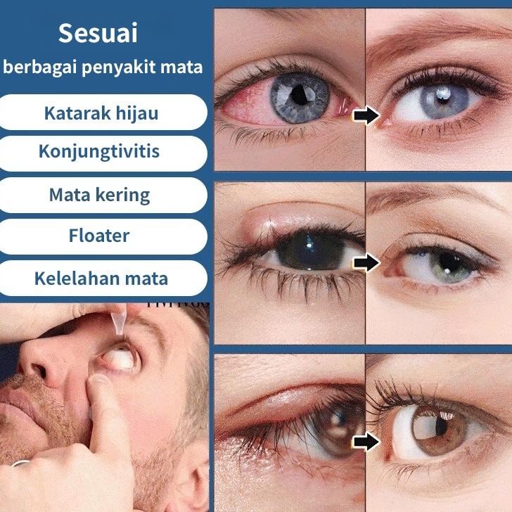 Ready Meningkatkan PenglihatanObat Tetes Mata Jepang (15Ml) Cairan Perawatan Mata Obat Tetes Mata Un
