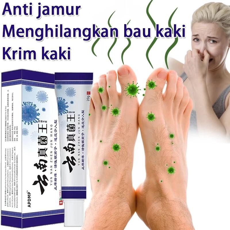 20G Obat Kaki Menghilangkan Bau Kaki Salap Jamur Nystatin Salep Pereda Gatal Kulit Obat Kaki Rayapan