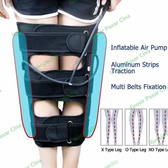 Alat Meluruskan kaki leg correction terapi X Pelurus kaki O X kaki X O