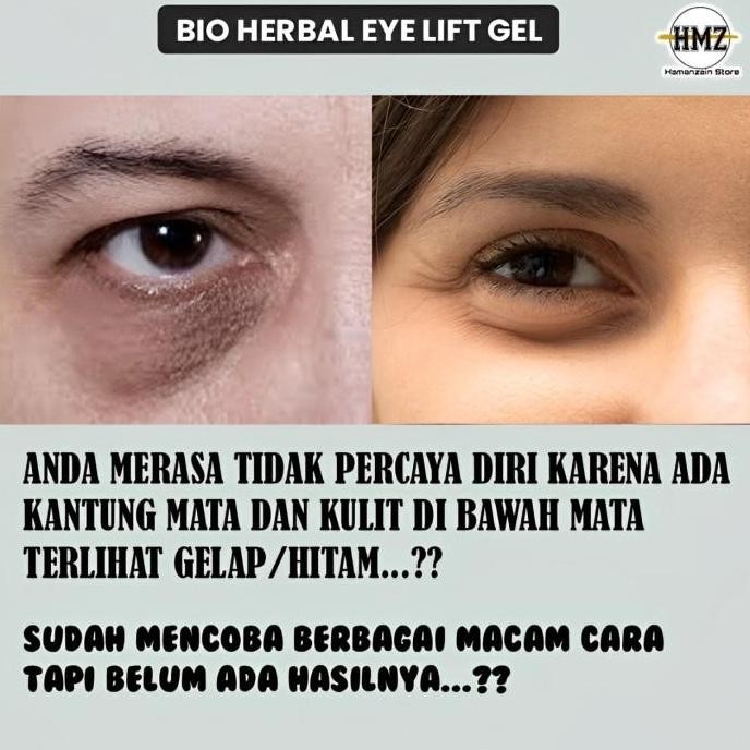 Eye mask cream Obat masker penghilang kantung mata panda pria wanita ampuh BPOM fs