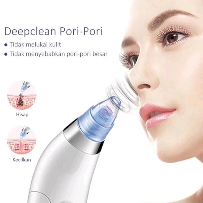 Pembersih Komedo Wajah Elektrik, Alat Facial Blackhead Remover Vacuum Suction Facial Cleaner Listrik
