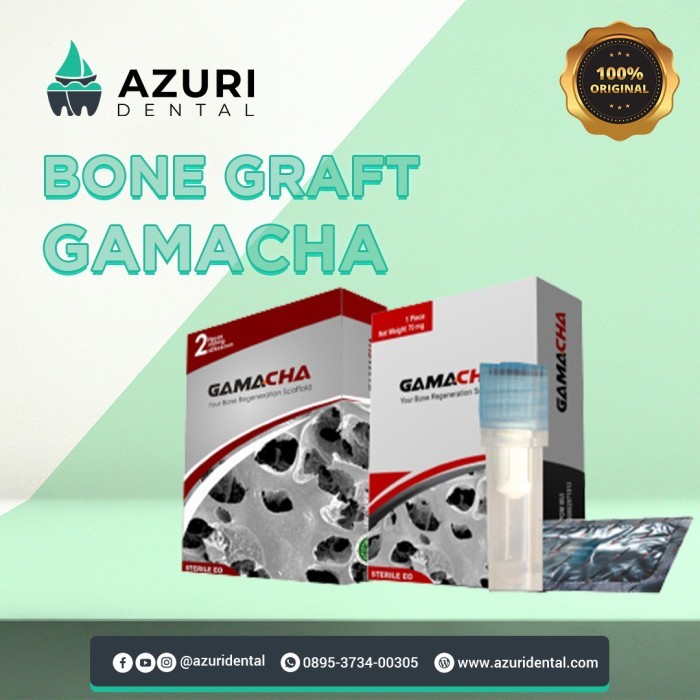 bone graft gamacha