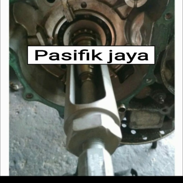 TERBARU Traker Gigi Sentrik Wipro Tracker Treker Buka Cabut Gigi Sintrik Bawah