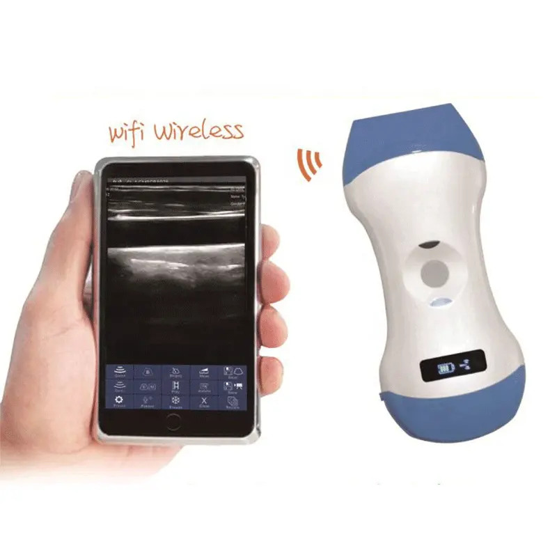 VANE Medical ultrasound instruments Portable Handheld Ultrasound Device Palm Portable Ultrasound Sca