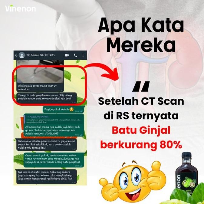 

Vinenon Cuka Mengkudu Asli Original Penghancur Batu Ginjal murah