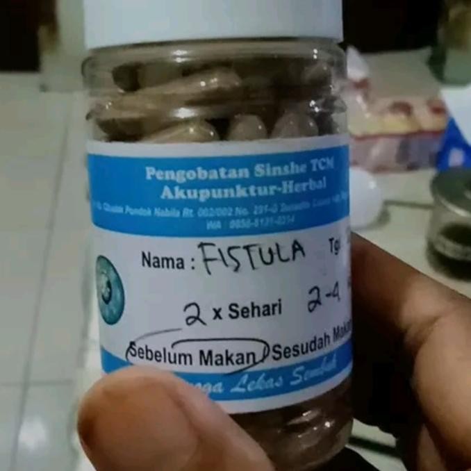 Obat Herbal Fistula Ani