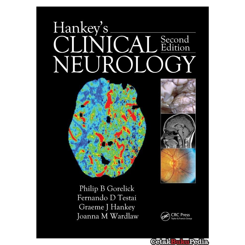 Book Hankey'S Clinical Neurology Second Edition Softcover