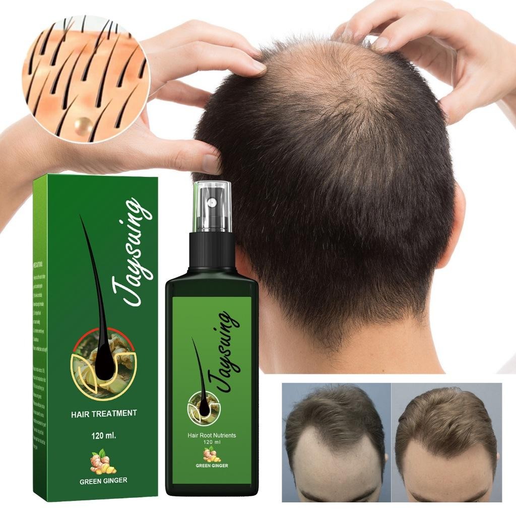 Jaysuing Serum Penumbuh Rambut 30Ml Hair Growth Spray Obat Penumbuh Rambut Penumbuh Rambut Botak Ser