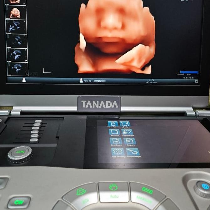 Terlaris Usg 4 Dimensi / Usg 4D Tanada Gamma8 Ready Stok