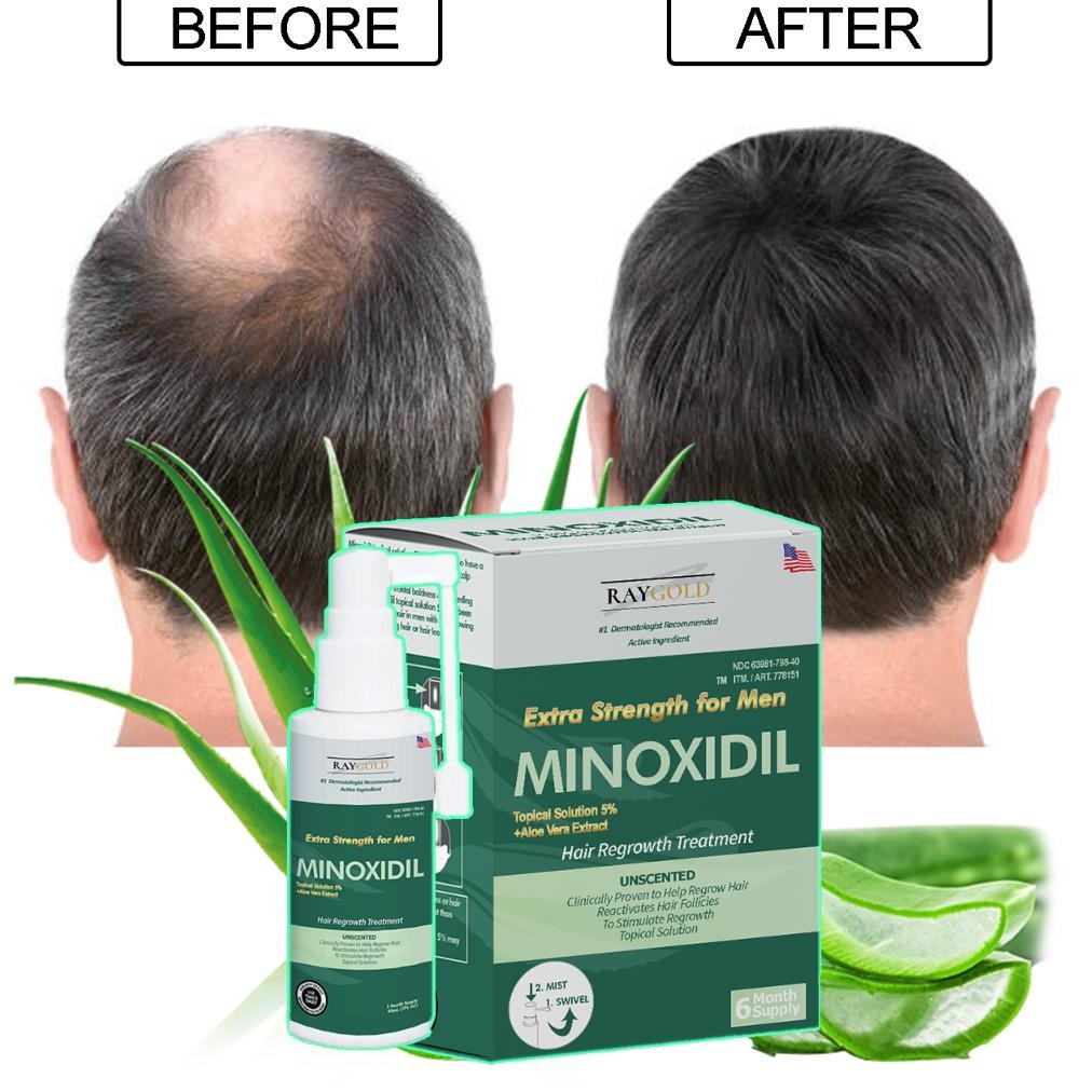 MINOXIDIL 5% penumbuh rambut & brewok with Aloe Vera for MEN made in USA - RAYGOLD - anti rontok & k