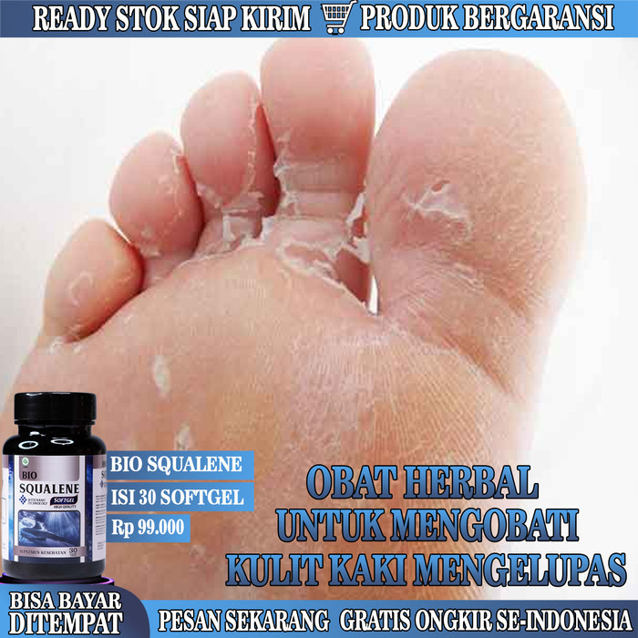 HEMAT Obat Telapak Kaki Mengelupas, Obat Kaki Kering kulit mengelupas