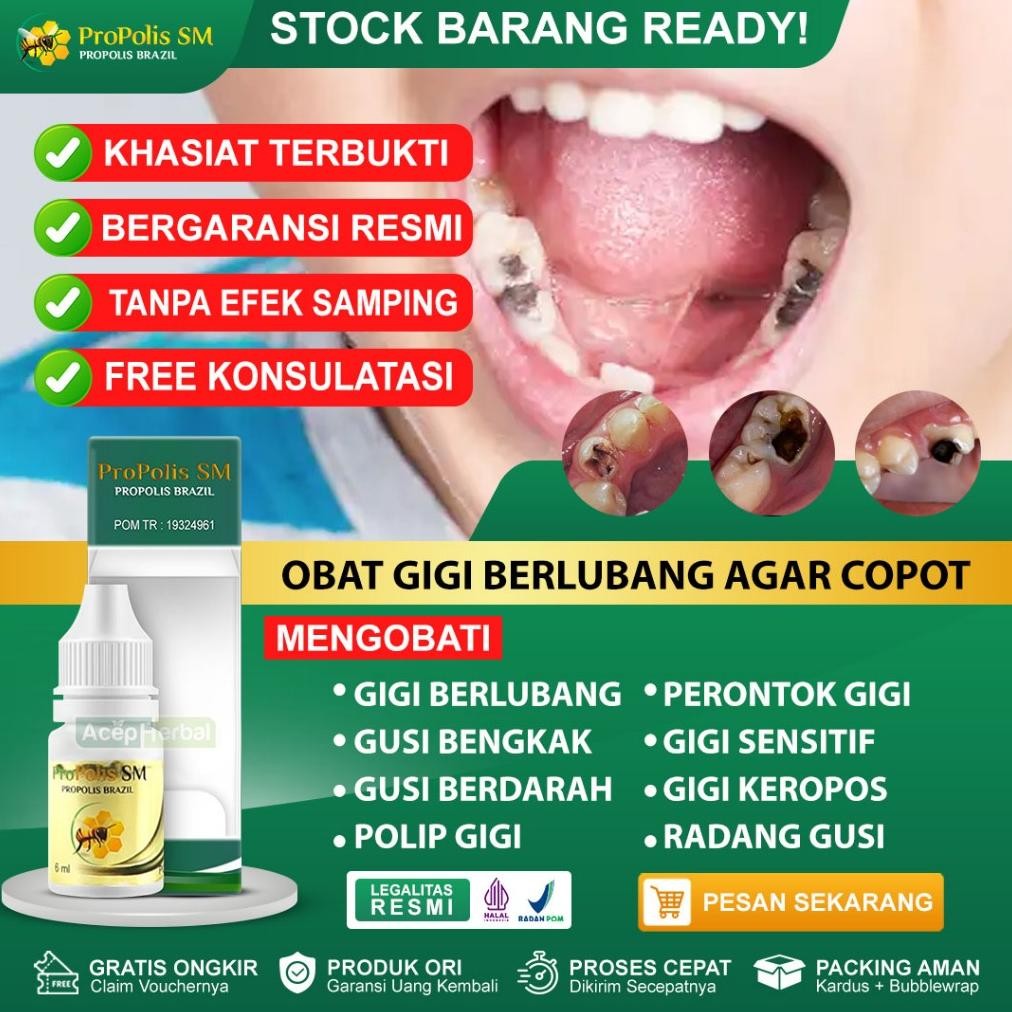 CHRIS OBAT GIGI BERLUBANG AGAR COPOT POLIP GIGI GIGI SENSITIF GIGI KEROPOS GUSI BENGKAK GUSI BERDARA