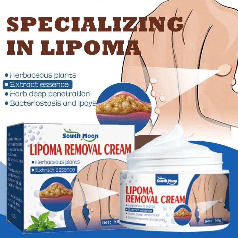 Lipoma Removal Cream 50G Herbal Cina Krim Obat Benjolan Lipoma Obat Lipoma Perawatan Punggung/Leher/
