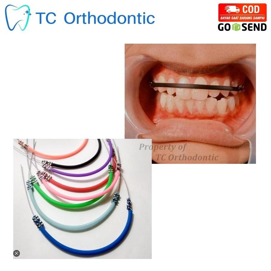 Karet Thailand Untuk Behel Gigi Warna Hijau / Karet Behel Gigi Thailand