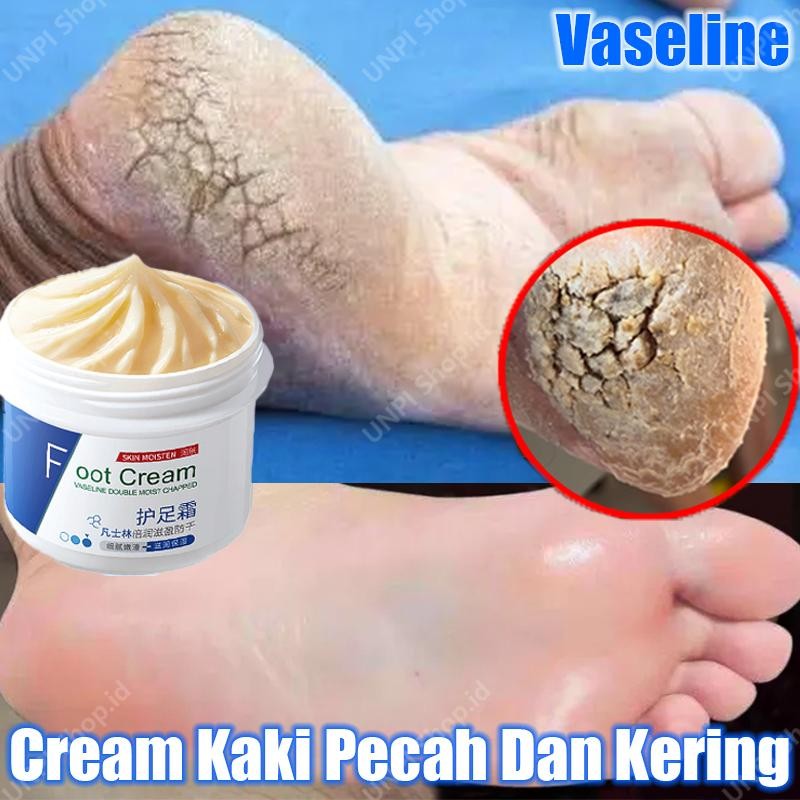 Vaseline Cream Kaki Pecah Dan Kering Obat Kaki Pecah Krim Kaki Pecah Dan Kering Foot Cream Kaki Peng