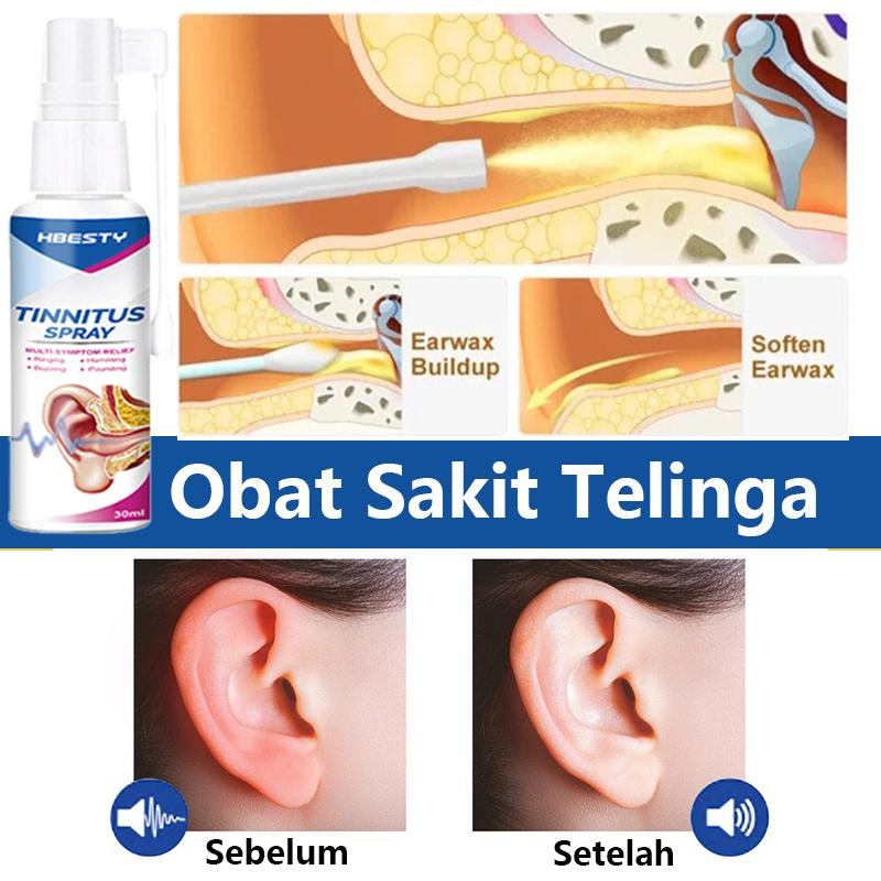 Obat Tetes Telinga Obat Sakit Telinga Obat Telinga Bernanah Sakit Telinga Pembersih Telinga Tersumba