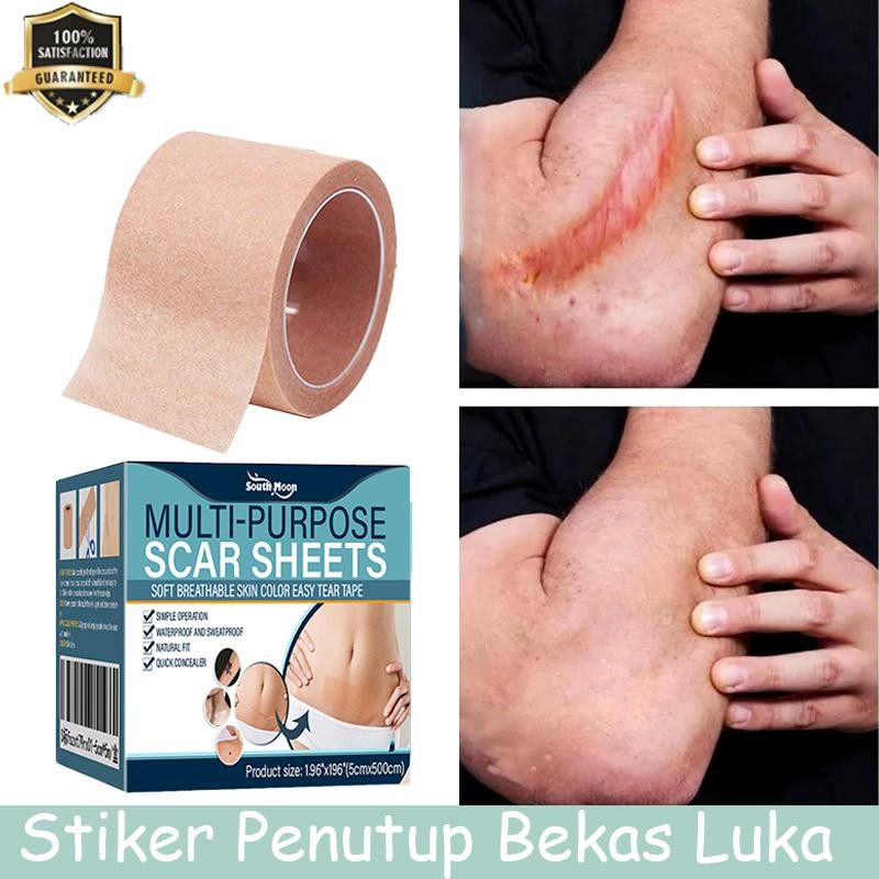 Silicone Scar Sheet Penghilang Bekas Luka Tambalan Concealer  Penutup Tattoo Stiker Penutup Bekas Lu