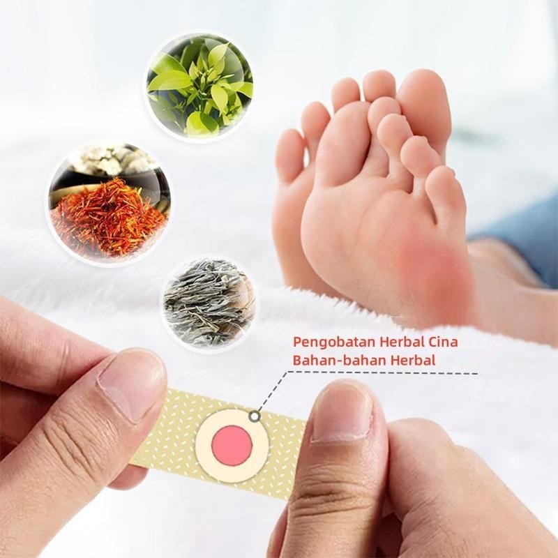 Plester Mata Ikan Patch Mata Ikan Plester Penghilang Kutil Plester Kutil Kapalan Foot Corn Removal P