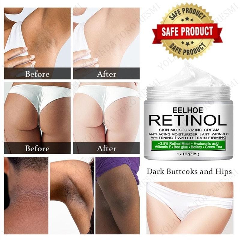 Eelhoe Retinol Cream Body Whitening Cream 20Ml Original Krim Pemutih Ketiak Dan Selangkangan Retinol