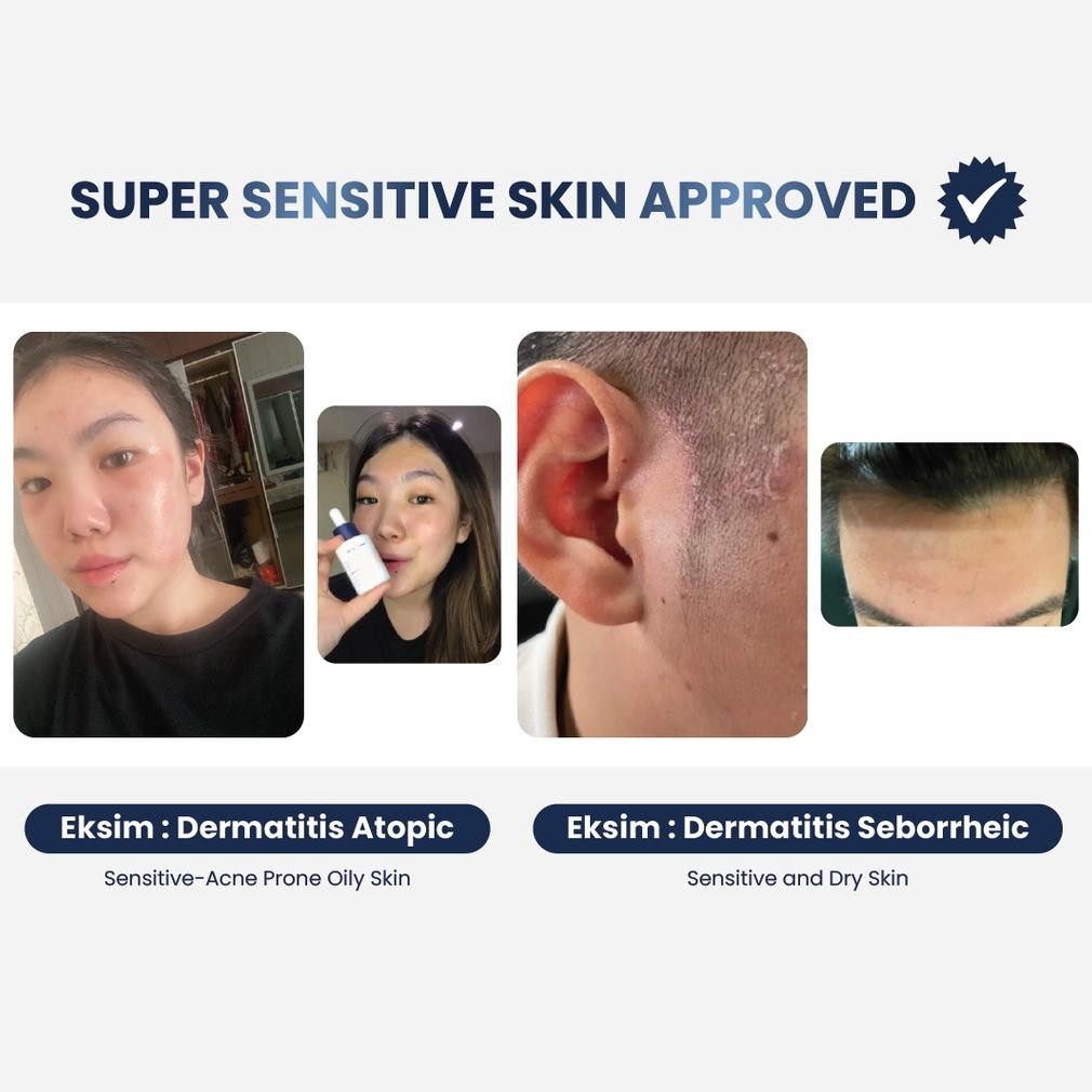 Er-87 Skin Time Probiotic Rebalance Gentle Cleanser 100 Ml | Skin Barrier Repair | Kulit Sensitif Je