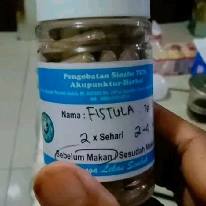 

TERBARU - Fistula Ani Racikan Sinshe