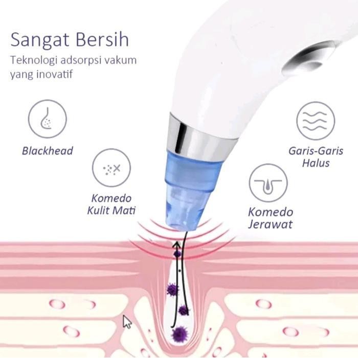 Pembersih Komedo Wajah Elektrik, Alat Facial Blackhead Remover Vacuum Suction Facial Cleaner Listrik