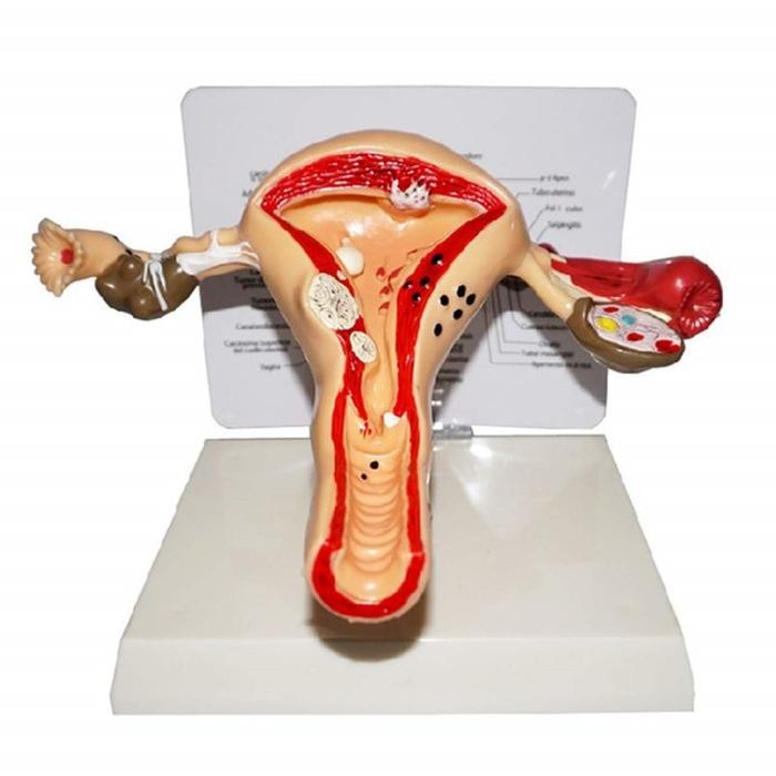 

terbaru !!! uterus ovary anatomical model anatomy alat peraga anatomi model patologis uterus ovarium