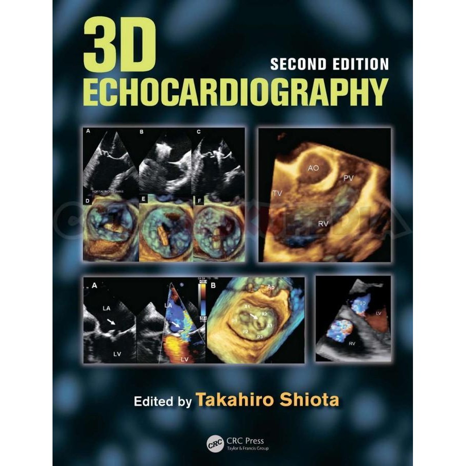 

Book 3D Echocardiography Second Edition - Print Warna Softcover