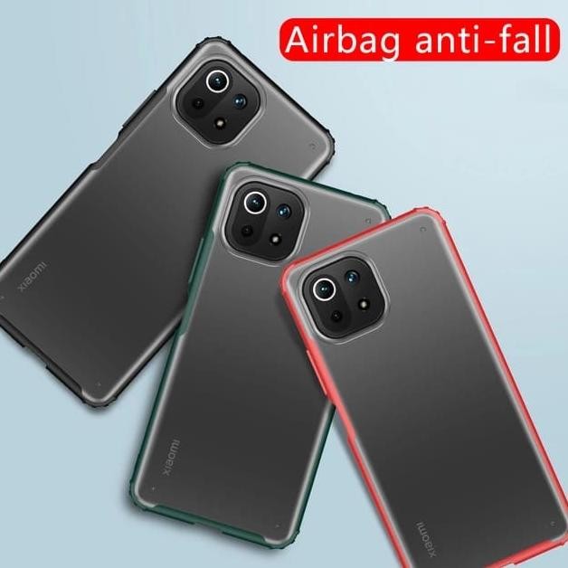 XIAOMI MI 11 LITE SOFT CASE FROSTED PREMIUM TRITONE SERIES ORIGINAL murah