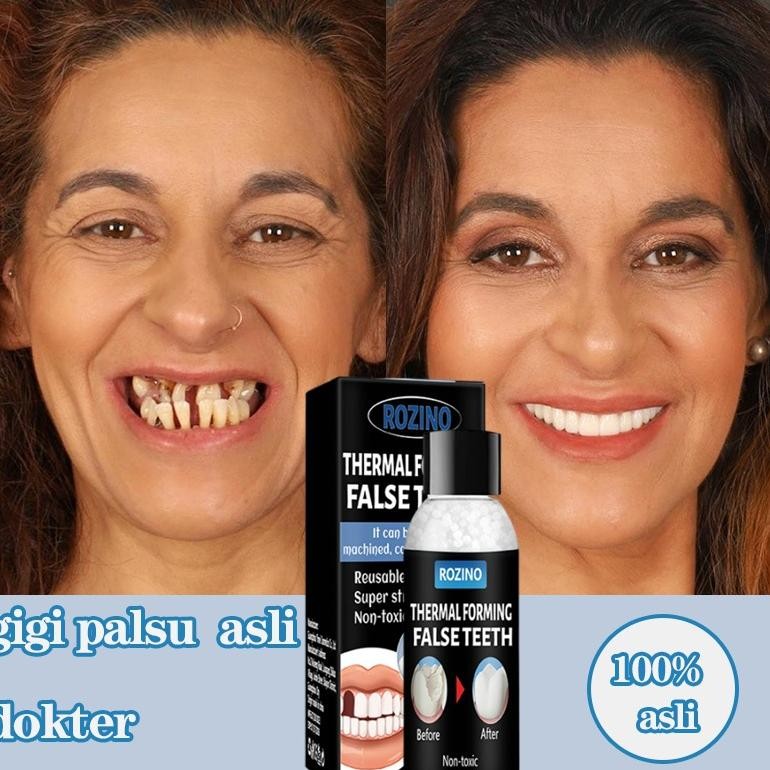 KALLIO PENAMBAL GIGI TAMBAL GIGI GIGI PALSU TAMBAL GIGI PERMANEN PENAMBAL GIGI BERLUBANG 30ML PENAMB