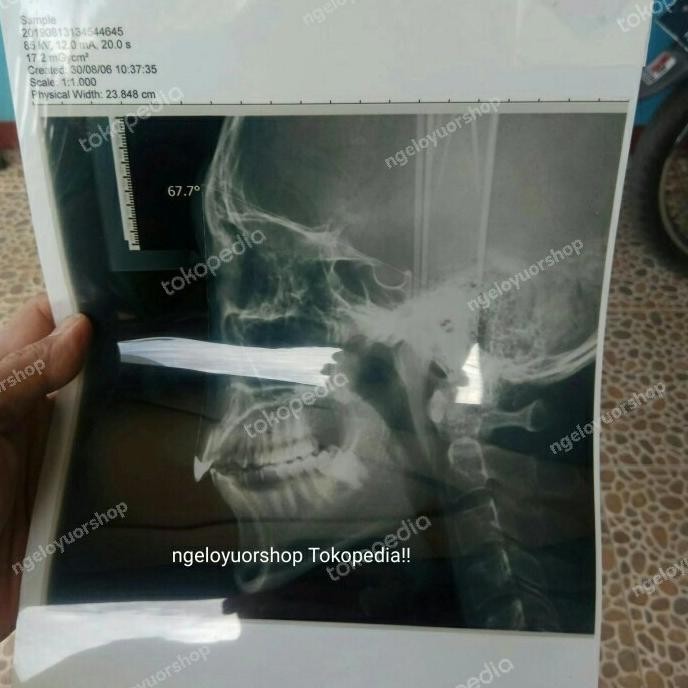 

paper yc film inkjet Rontgen paper film ronses A4 murah