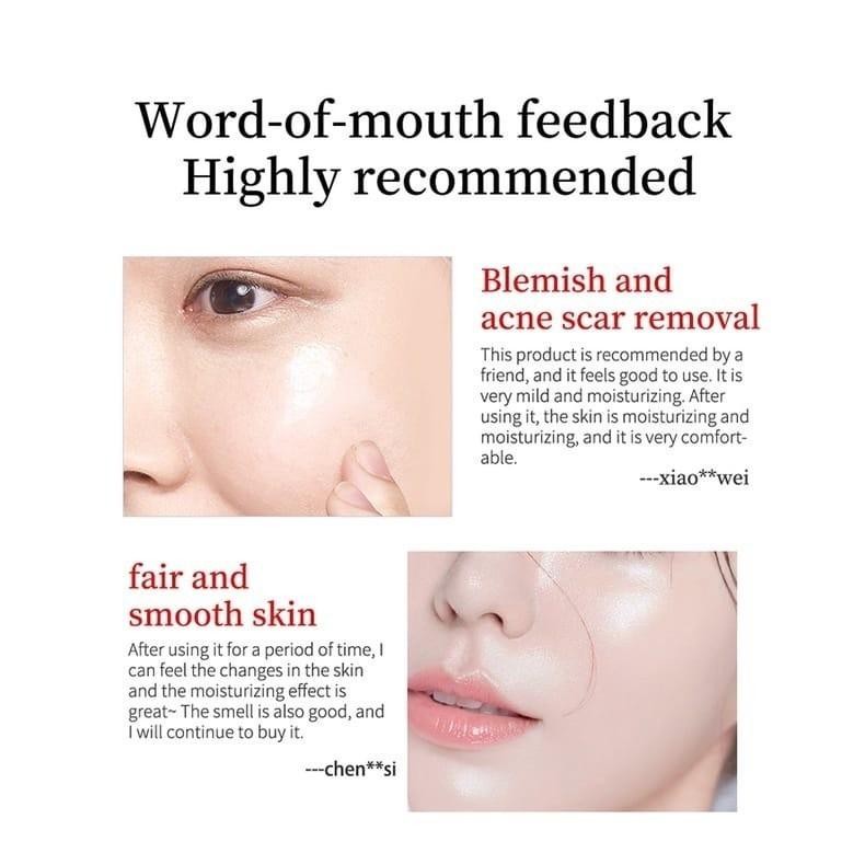 Ls Fuyan Cream Penghilang Flek Hitam Nicotinamide Spot Whitening Cream 20G