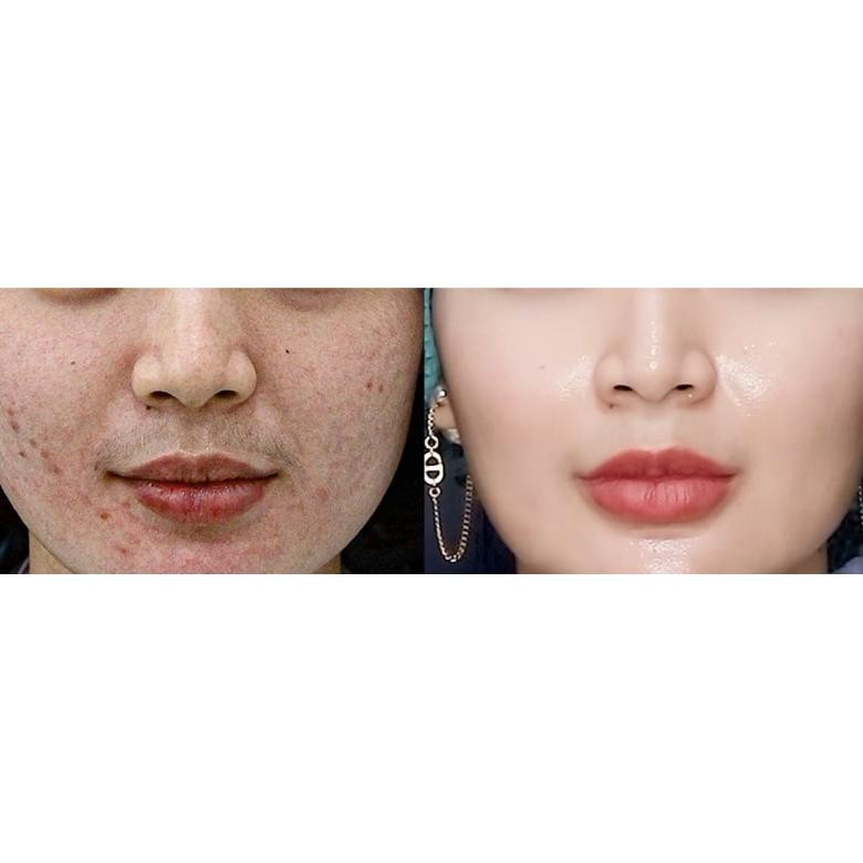 Terbaru Retinol Vita K Boost Cream Tom Tit Tot Tomtittot Premium By Beriz Beauty