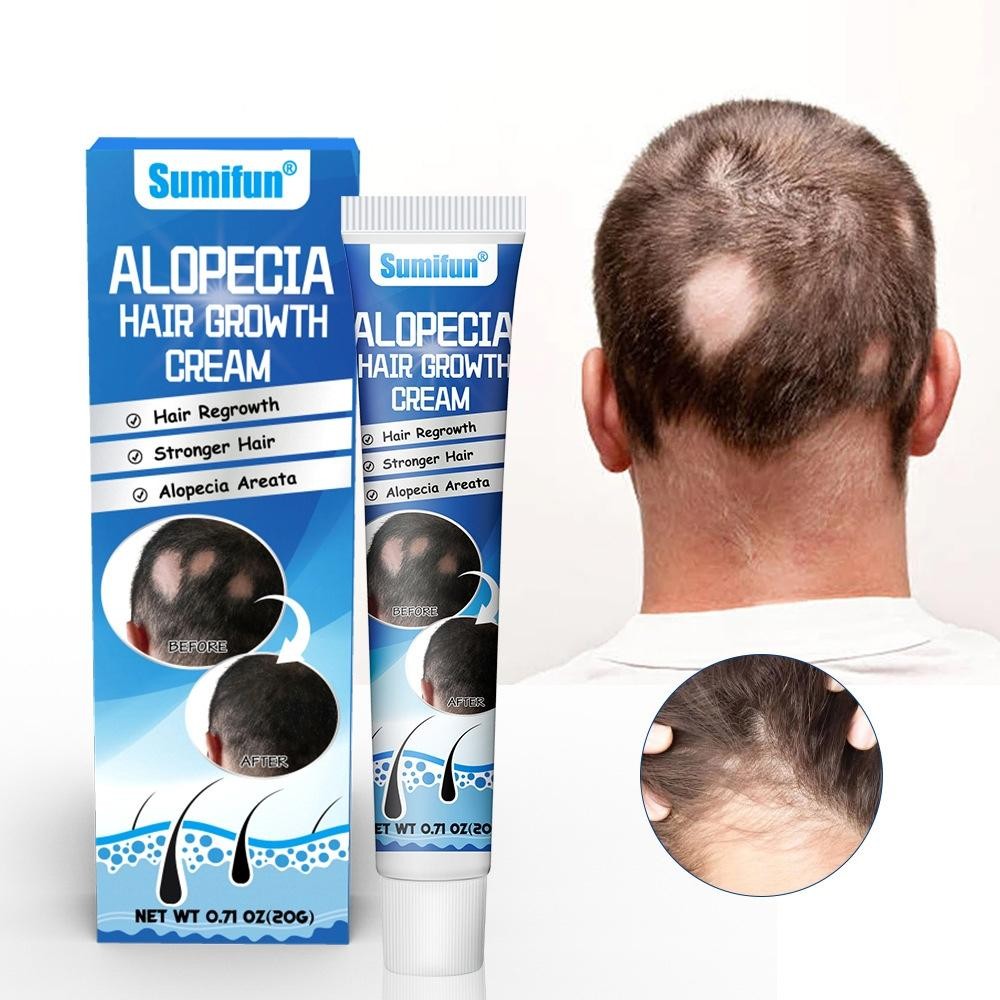 Obat Alopecia Areata, Obat Penumbuh Rambut Rontok Cepat 20G Penumbuh Rambut Cepat Serum, Penumbuh Ra