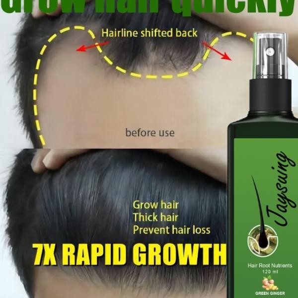Erum Umbuh Rambut Cepat Hair Tonic Rambut Ronto Erum Emprotan Umbuh Rambut Hair Growth Erum Ebal Ram