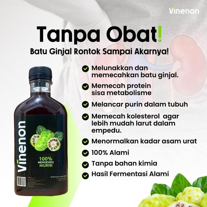 

terbaru !!! vinenon - paket 2 botol - cuka mengkudu asli - halal - bpom putih lemon ready