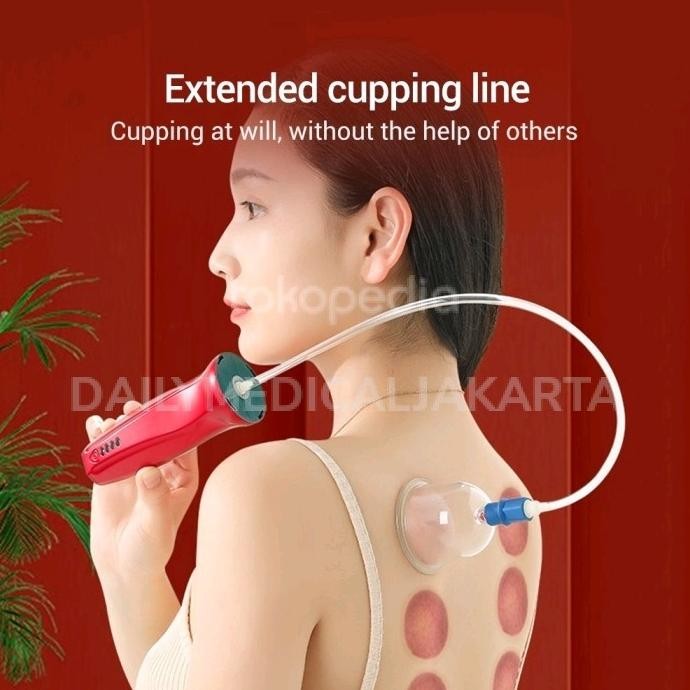 Alat Terapi Bekam Kop Angin Elektrik Cas - Electric Cupping Device SHA
